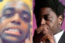 Kodak Black