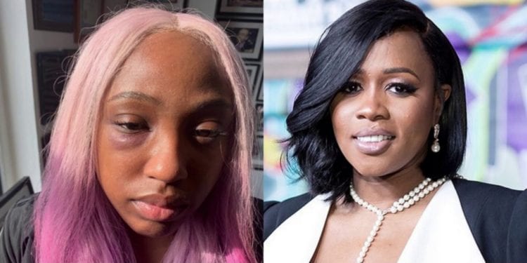 Assault Charges Dropped Against Remy Ma