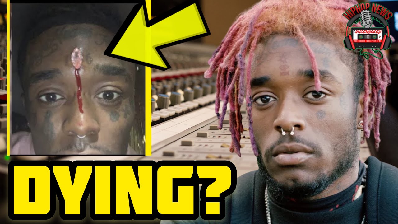 Lil Uzi Vert Pierced Forehead W 24m Diamond Hip Hop News Uncensored