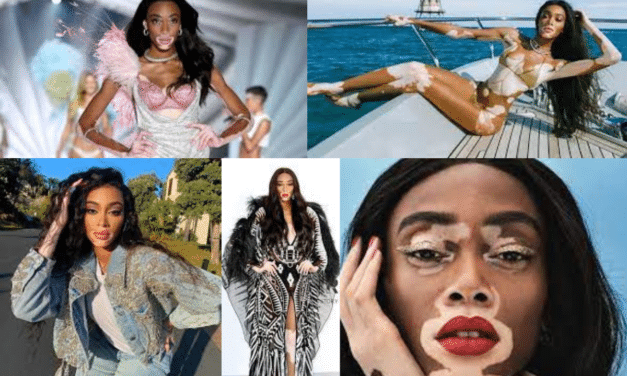 Winnie Harlow: Winning